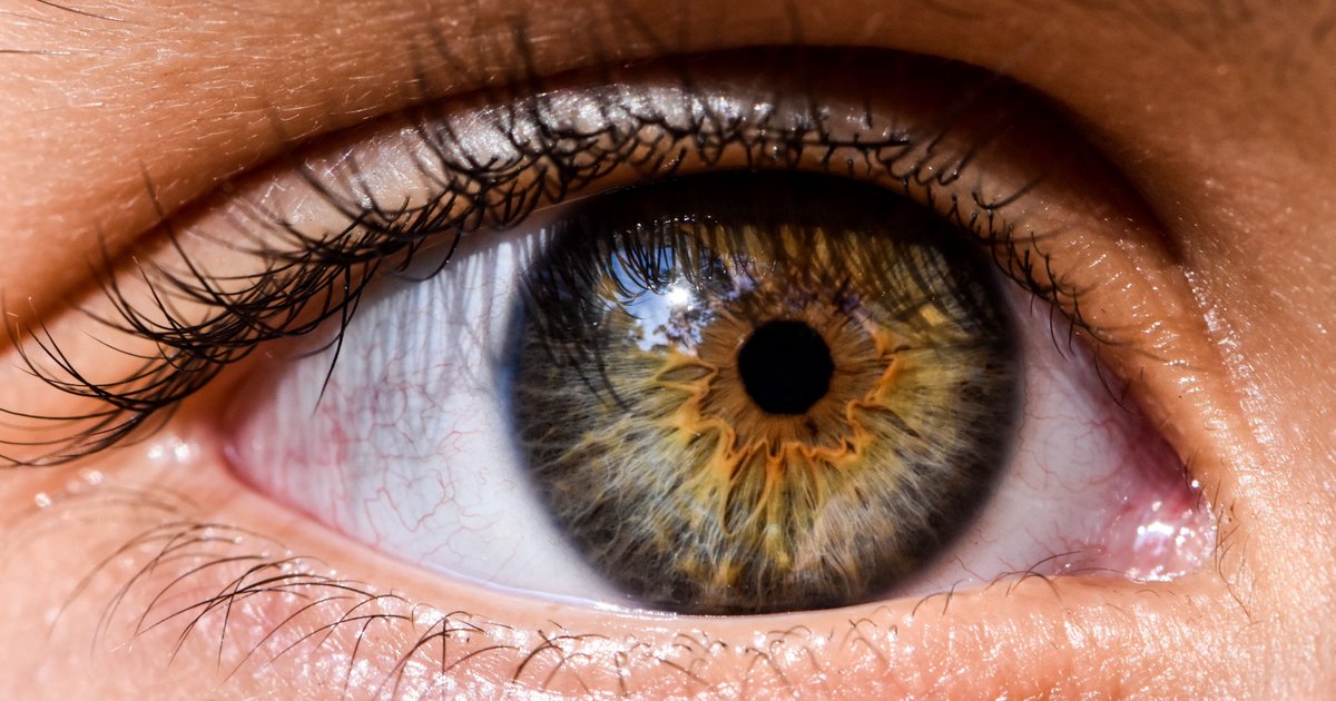 Τι είναι το IRIS σύστημα