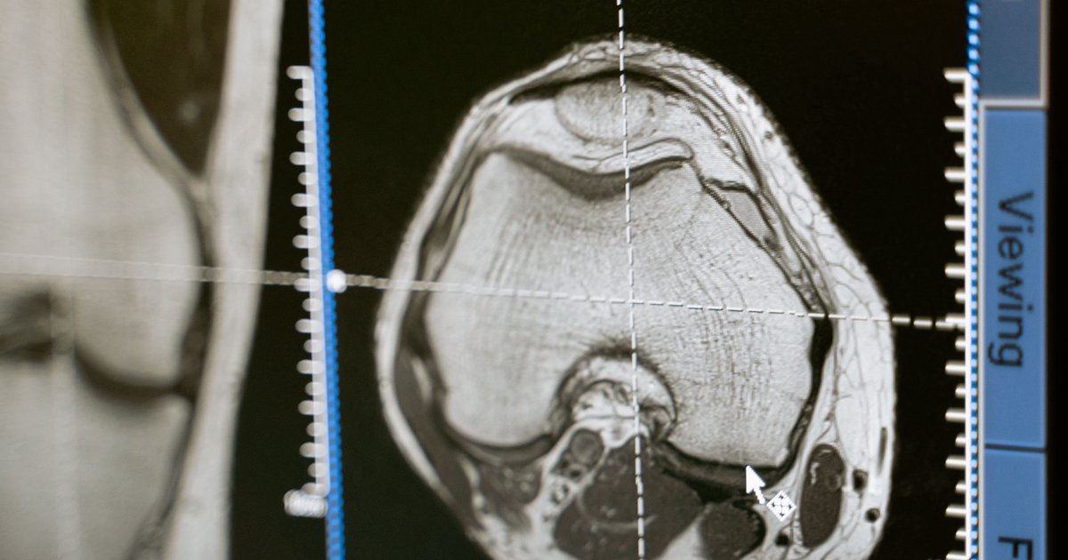 PET scan τι είναι και χρήση